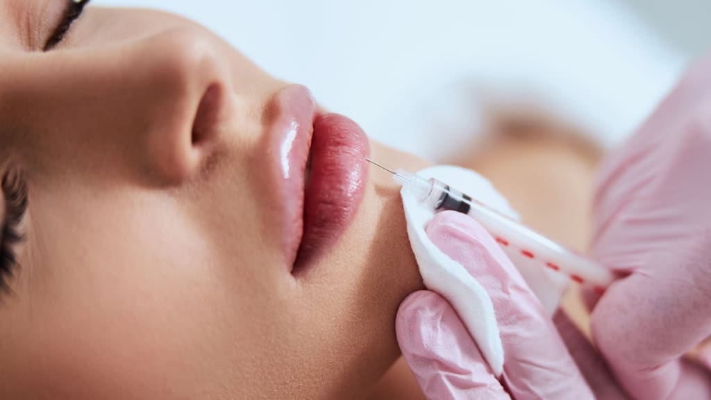 Lip filler injection at Skin Lab Med Spa in Falls Church, VA