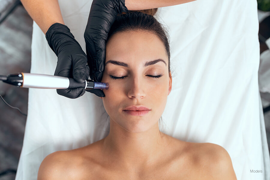 RF microneedling treatment at Skin Lab Med Spa in Falls Church, VA